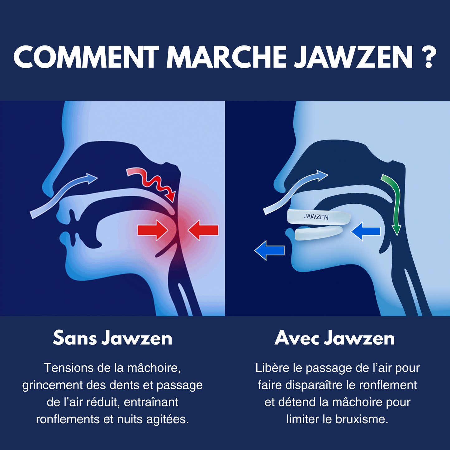 Protège-Dents Anti-Ronflement et Anti-Bruxisme